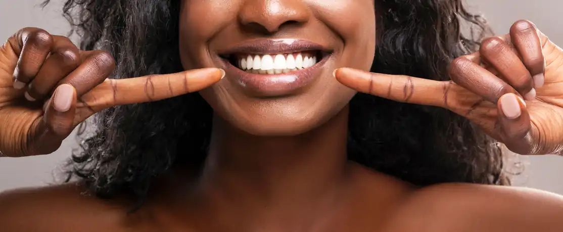 Smile Makeover