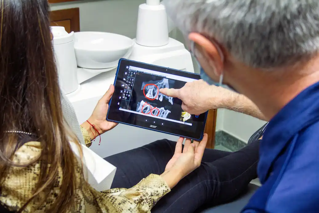 Wisdom Tooth Removal